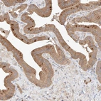 Anti-RAB23 Antibody