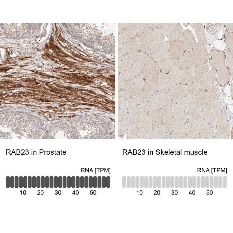 Anti-RAB23 Antibody