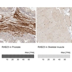 Anti-RAB23 Antibody