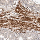 Immunohistochemical staining of human prostate shows strong cytoplasmic positivity in smooth muscle cells.