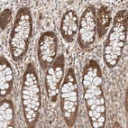 Immunohistochemical staining of human rectum shows strong cytoplasmic positivity in glandular cells.