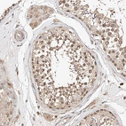 Immunohistochemical staining of human testis shows moderate cytoplasmic positivity in cells in seminiferous ducts.