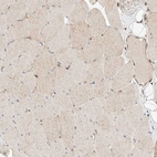 Immunohistochemical staining of human skeletal muscle shows weak cytoplasmic positivity in myocytes.