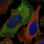 Immunofluorescent staining of human cell line U-2 OS shows localization to plasma membrane, cytosol & centrosome.