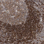 Immunohistochemical staining of human tonsil shows strong cytoplasmic positivity in non-germinal center cells.