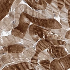 Immunohistochemical staining of human skeletal muscle shows strong cytoplasmic positivity in myocytes.