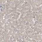 Immunohistochemical staining of human liver shows no cytoplasmic positivity in hepatocytes as expected.