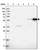 Lane 1: Marker [kDa] 230, 130, 95, 72, 56, 36, 28, 17, 11_br/_Lane 2: Human cell line RT-4_br/_Lane 3: Human cell line U-251MG sp_br/_Lane 4: Human plasma (IgG/HSA depleted)_br/_Lane 5: Human liver tissue_br/_Lane 6: Human tonsil tissue