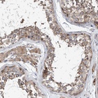 Anti-CEP85L Antibody