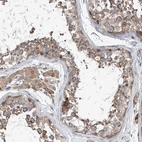 Anti-CEP85L Antibody