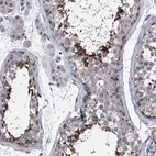 Anti-CEP85L Antibody