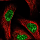 Immunofluorescent staining of human cell line U-2 OS shows localization to nuclear speckles.