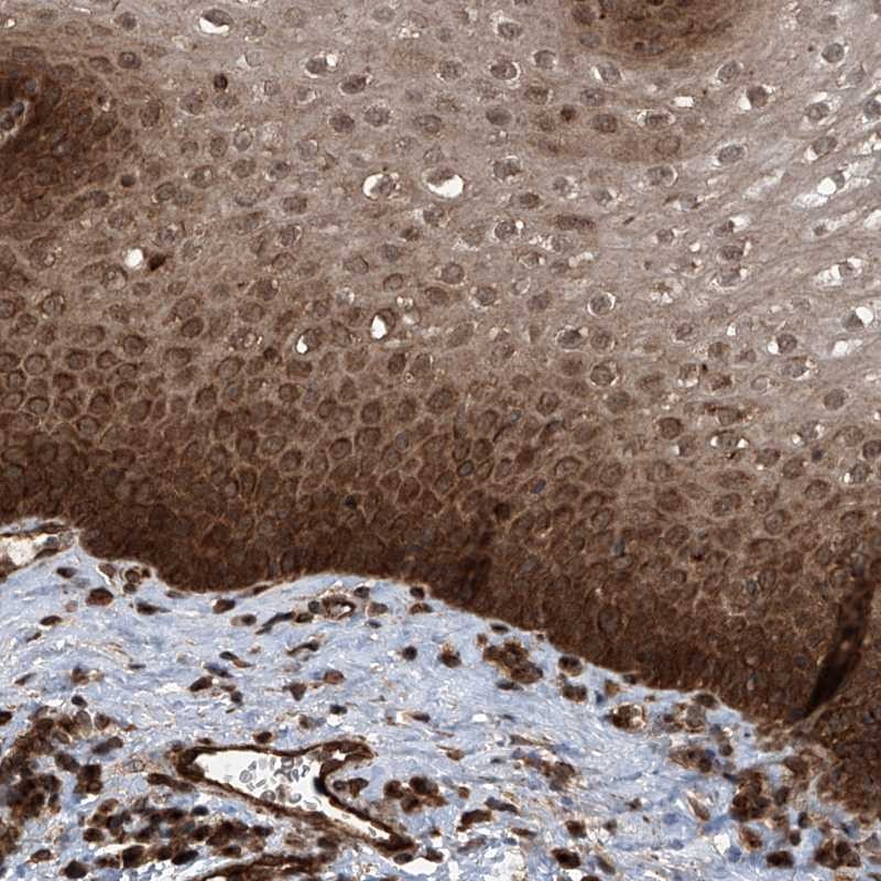 Anti-LYSMD4 Antibody