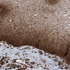 Anti-LYSMD4 Antibody