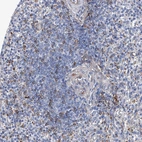 Anti-FPR2 Antibody