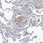 Immunohistochemical staining of human lung shows strong cytoplasmic positivity in granulocytes.