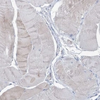 Immunohistochemical staining of human skeletal muscle shows no positivity in myocytes as expected.