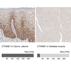 Anti-CTNNB1 Antibody