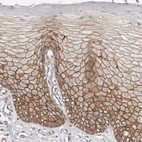 Immunohistochemical staining of human cervix, uterine shows moderate membranous positivity in squamous epithelial cells.