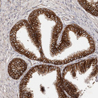 Anti-CTNNB1 Antibody