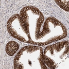 Immunohistochemical staining of human prostate shows moderate membranous positivity in glandular cells.