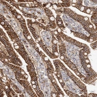 Immunohistochemical staining of human duodenum shows moderate membranous positivity in glandular cells.