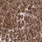 Immunohistochemical staining of human pancreas shows moderate membranous positivity in exocrine glandular cells.