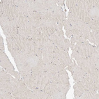 Immunohistochemical staining of human skeletal muscle shows weak positivity in myocytes.
