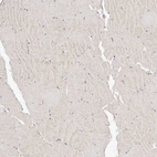 Immunohistochemical staining of human skeletal muscle shows weak positivity in myocytes.