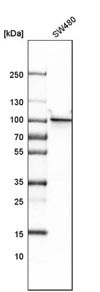 Western blot analysis in human cell line SW480.