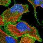 Immunofluorescent staining of human cell line U-2 OS shows localization to plasma membrane.