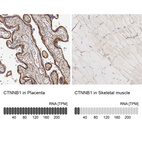 Anti-CTNNB1 Antibody