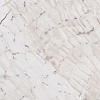 Immunohistochemical staining of human skeletal muscle shows low expression as expected.