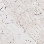 Immunohistochemical staining of human skeletal muscle shows low expression as expected.