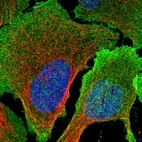 Immunofluorescent staining of human cell line U-2 OS shows localization to plasma membrane.