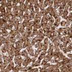 Anti-APOL6 Antibody
