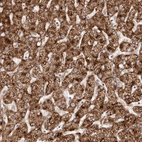 Anti-APOL6 Antibody