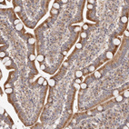Immunohistochemical staining of human Duodenum shows moderate granular cytoplasmic positivity in glandular cells.