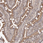 Immunohistochemical staining of human Duodenum shows moderate granular cytoplasmic positivity in glandular cells.