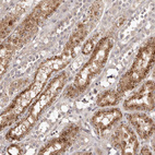 Immunohistochemical staining of human Kidney shows moderate granular cytoplasmic positivity in cells in distal tubules.