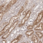 Immunohistochemical staining of human Kidney shows moderate granular cytoplasmic positivity in cells in distal tubules.