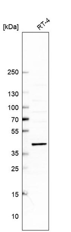 Western blot analysis in human cell line RT-4.