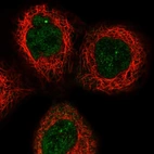 Immunofluorescent staining of human cell line A-431 shows localization to nuclear bodies.