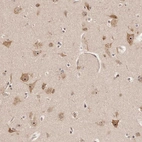 Anti-APOL6 Antibody