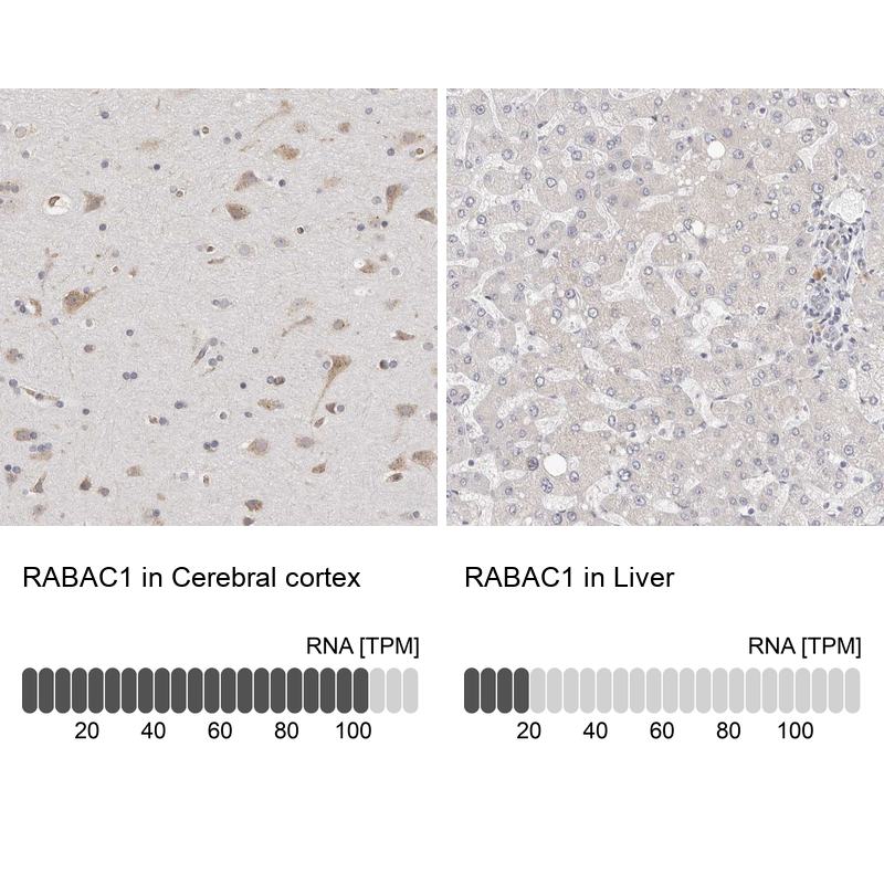 Anti-RABAC1 Antibody