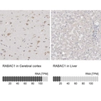 Anti-RABAC1 Antibody