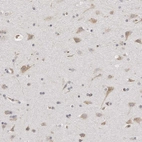 Immunohistochemical staining of human cerebral cortex shows high expression.