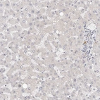 Immunohistochemical staining of human liver shows low expression as expected.