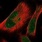 Immunofluorescent staining of human cell line U-251 MG shows localization to nucleoli fibrillar center & nuclear membrane.