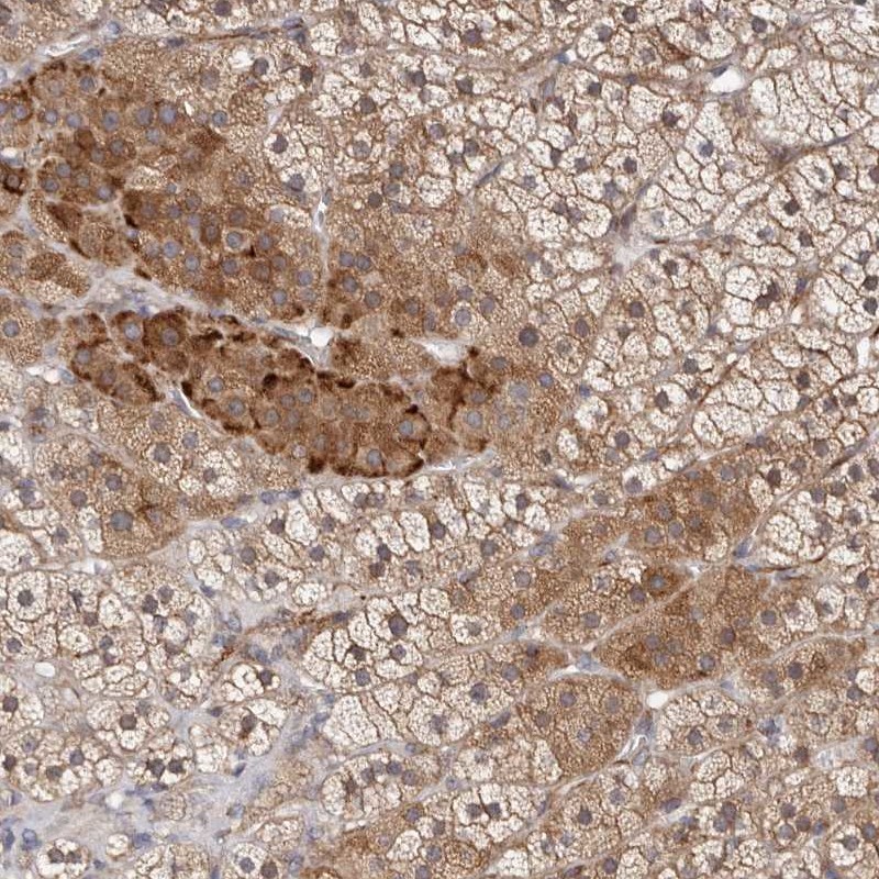 Anti-KLHL4 Antibody